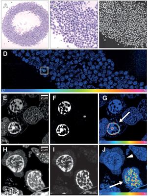 Tracking cell turnover in human brain using 15N-thymidine imaging mass spectrometry